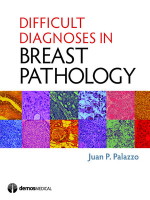 cover image of Difficult Diagnoses in Breast Pathology